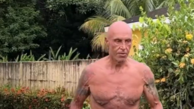 Kiko Matamoros se somete a su primer retoque estético tras salir de 'Supervivientes'