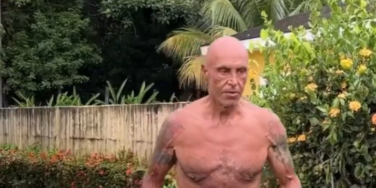 Kiko Matamoros se somete a su primer retoque estético tras salir de 'Supervivientes'