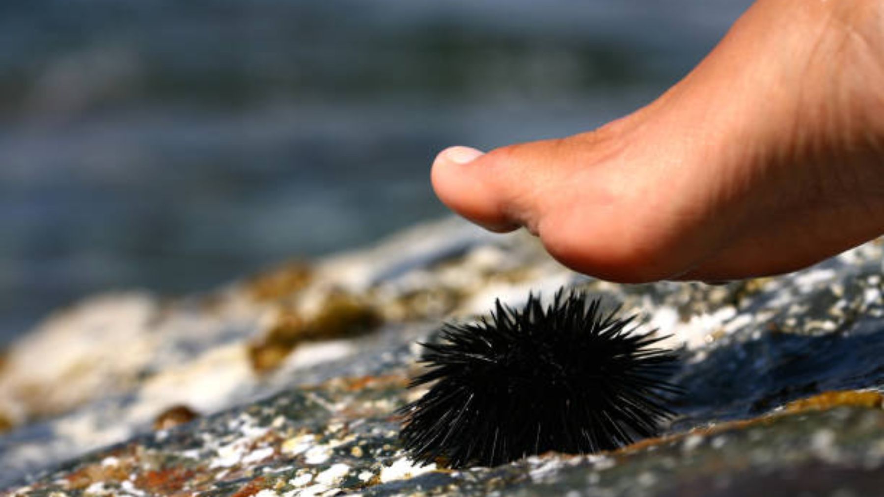 Qué hacer si te pinchas con un erizo de mar