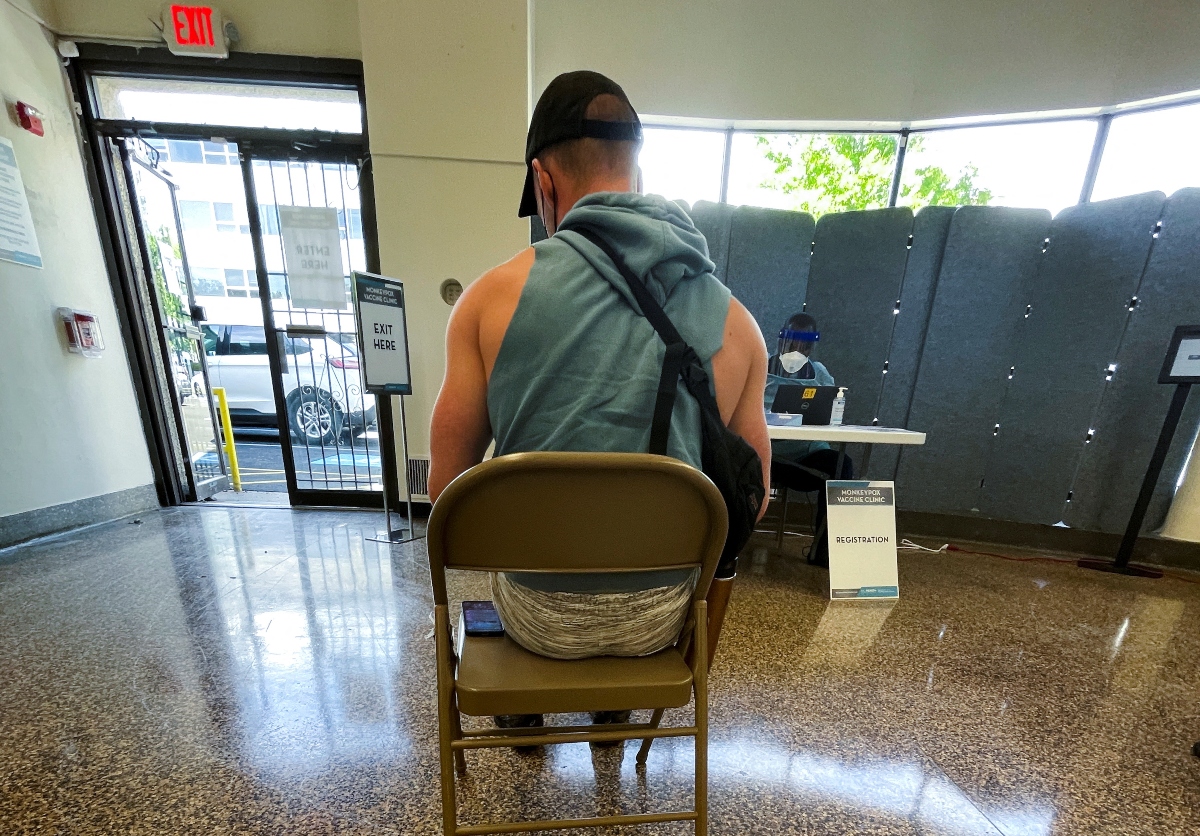 Reportan en Francia 1,700 casos de viruela del mono