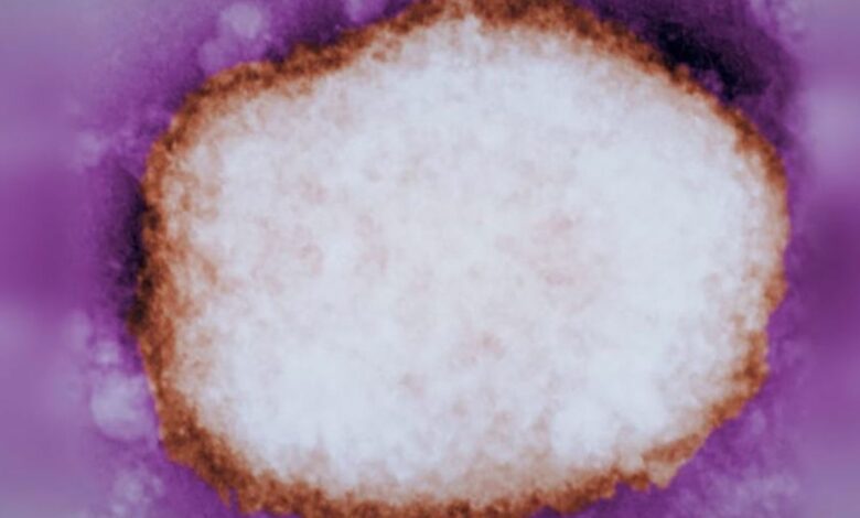 Viruela del mono se detecta con frecuencia en la saliva y en el semen