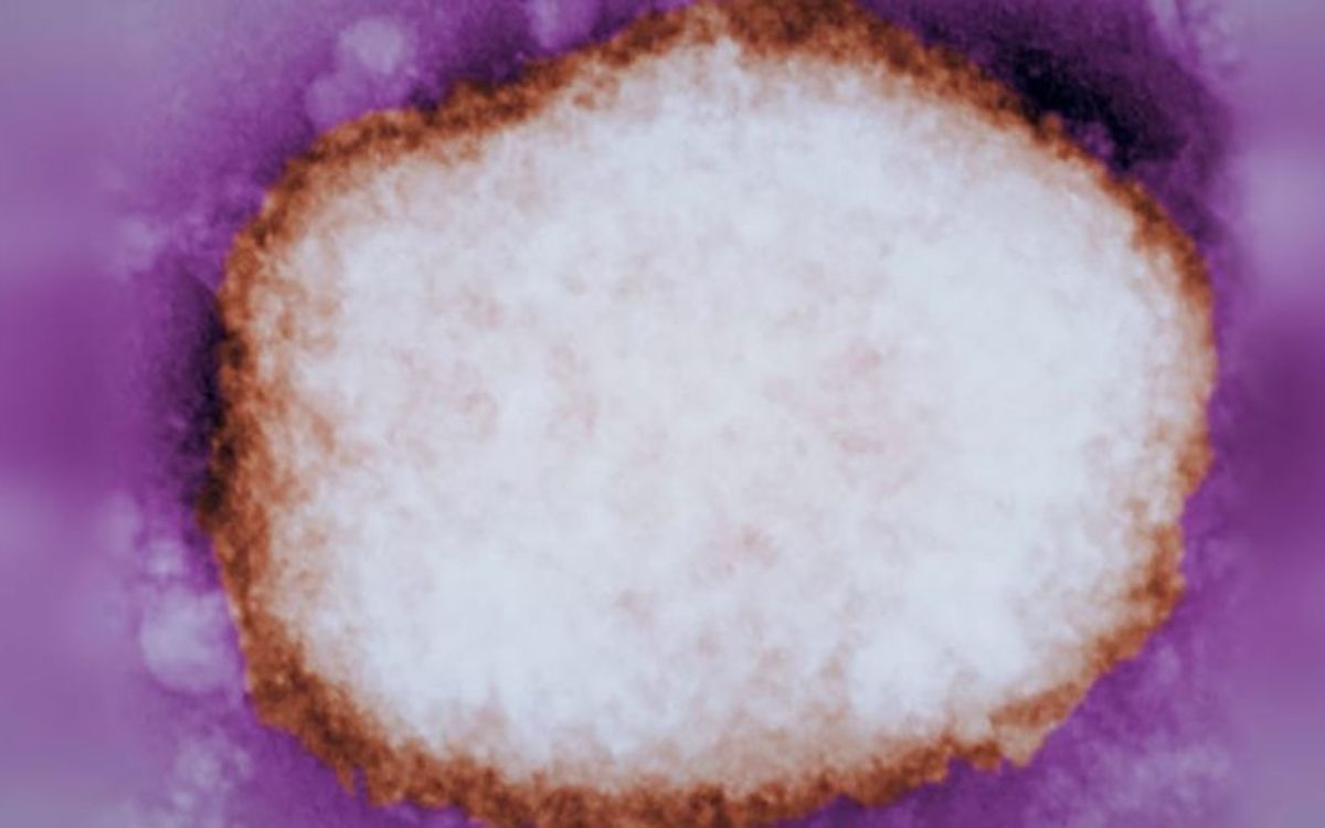 Viruela del mono se detecta con frecuencia en la saliva y en el semen