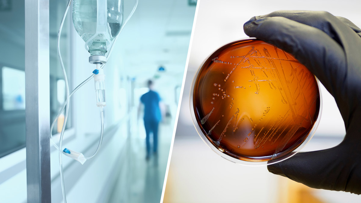 investigan mortal brote de listeria