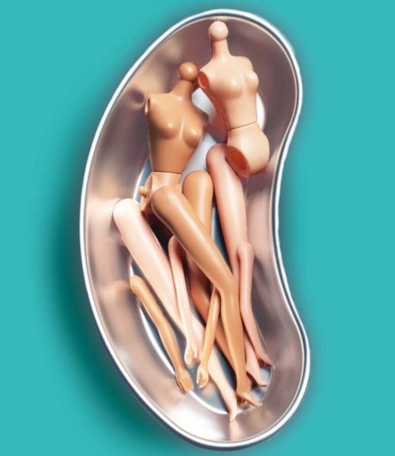 Portada del libro de feos