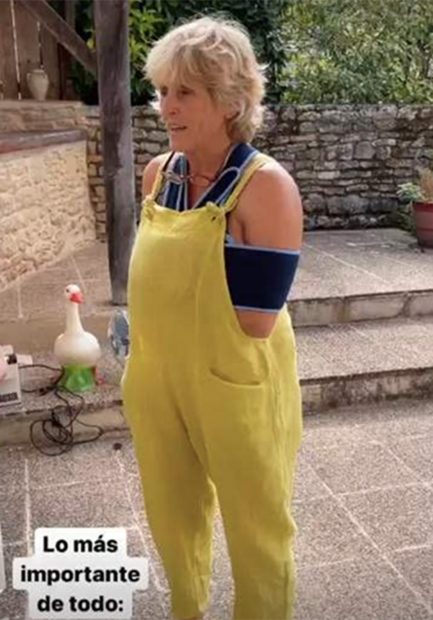 Mercedes Milá con el húmero roto / Instagram