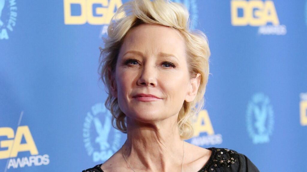 La actriz Anne Heche sufre muerte cerebral tras accidente en Los Ángeles