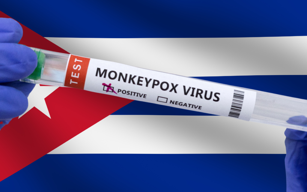 Cuba confirma su primer caso de viruela del mono