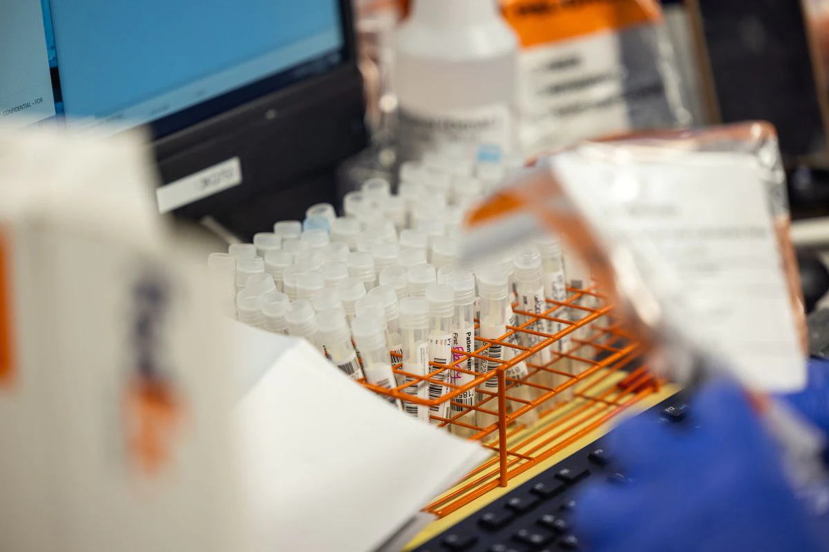 Ecuador confirma la muerte de un contagiado de viruela del mono con dolencias previas