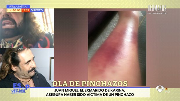 Juan Miguel en 'Espejo público' / Antena 3