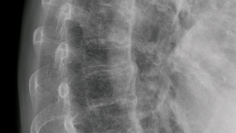 Las enfermedades raras que puede que no conozcas