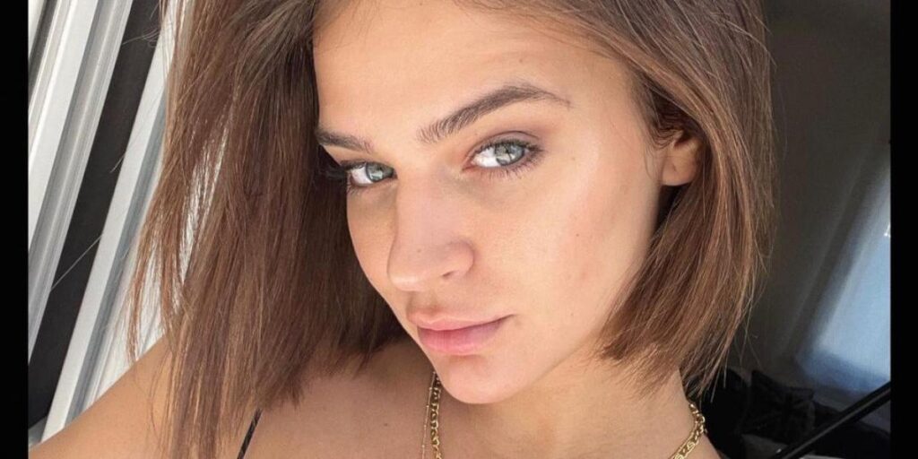 Laura Escanes preocupa a sus seguidores con una impactante imagen: "Me ha deformado el brazo"