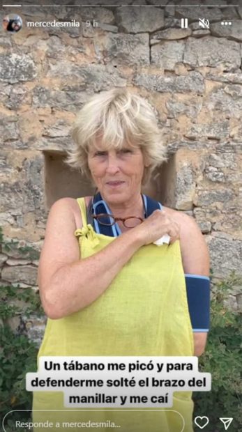 Mercedes Milá con el húmero roto / Instagram