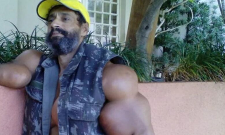 Muere el 'Hulk' brasileño, el fisicoculturista que se inyectaba aceite en sus músculos