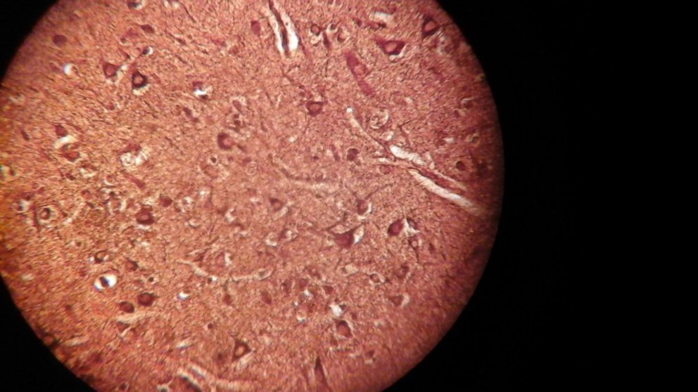 Neuronas espejo y la empatía, ¿para qué sirven?