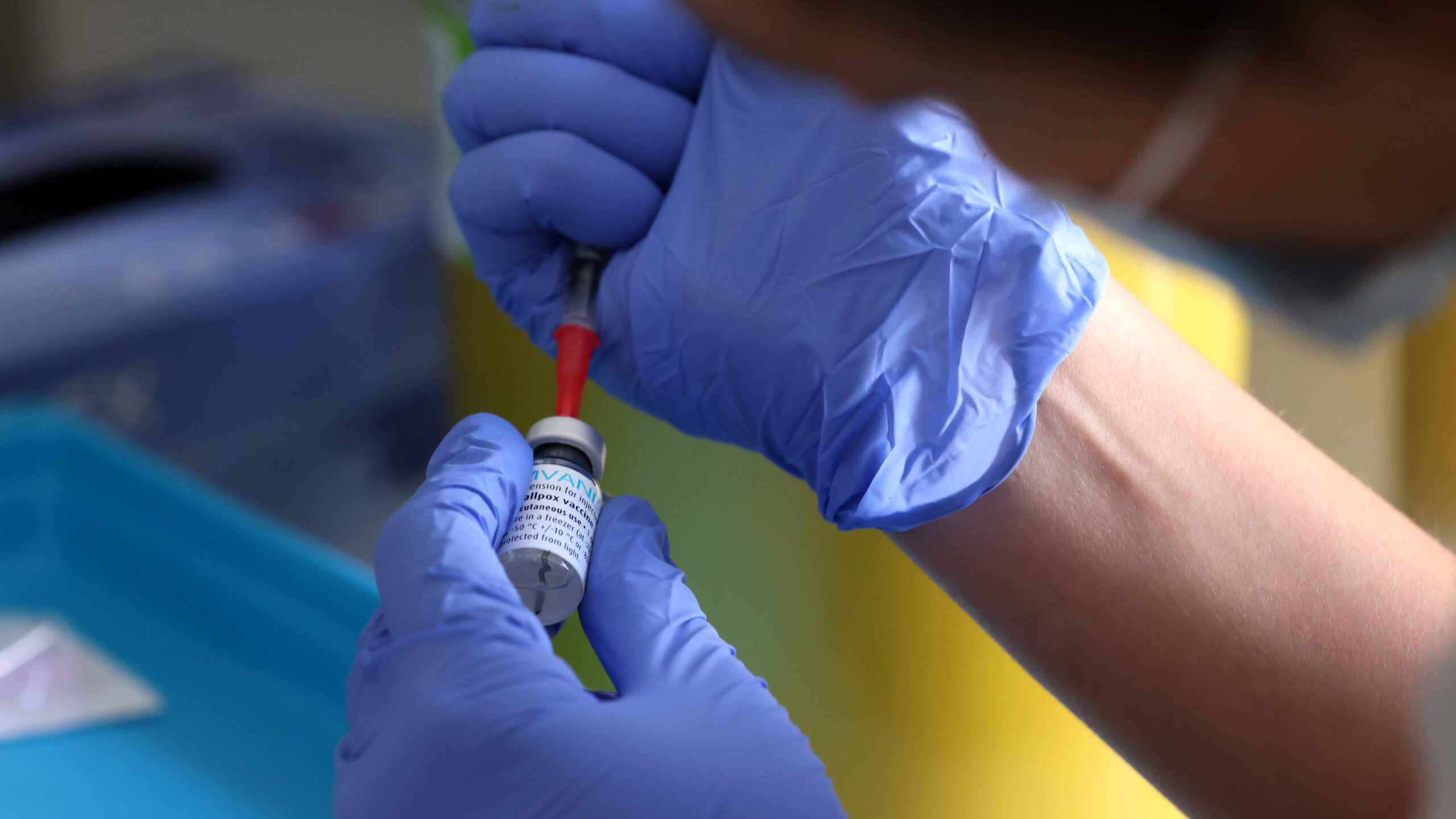 OMS renombrará la viruela del mono para evitar la estigmatización