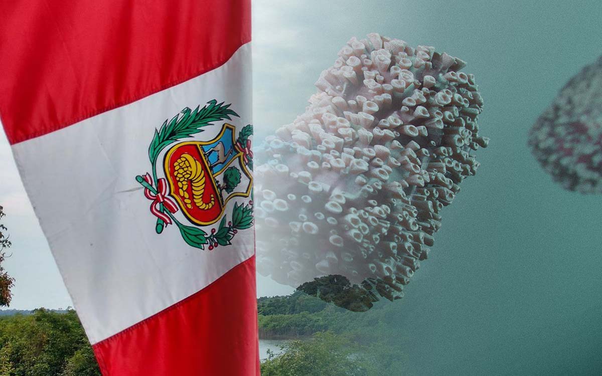 Perú reporta su primera muerte relacionada a la viruela del mono