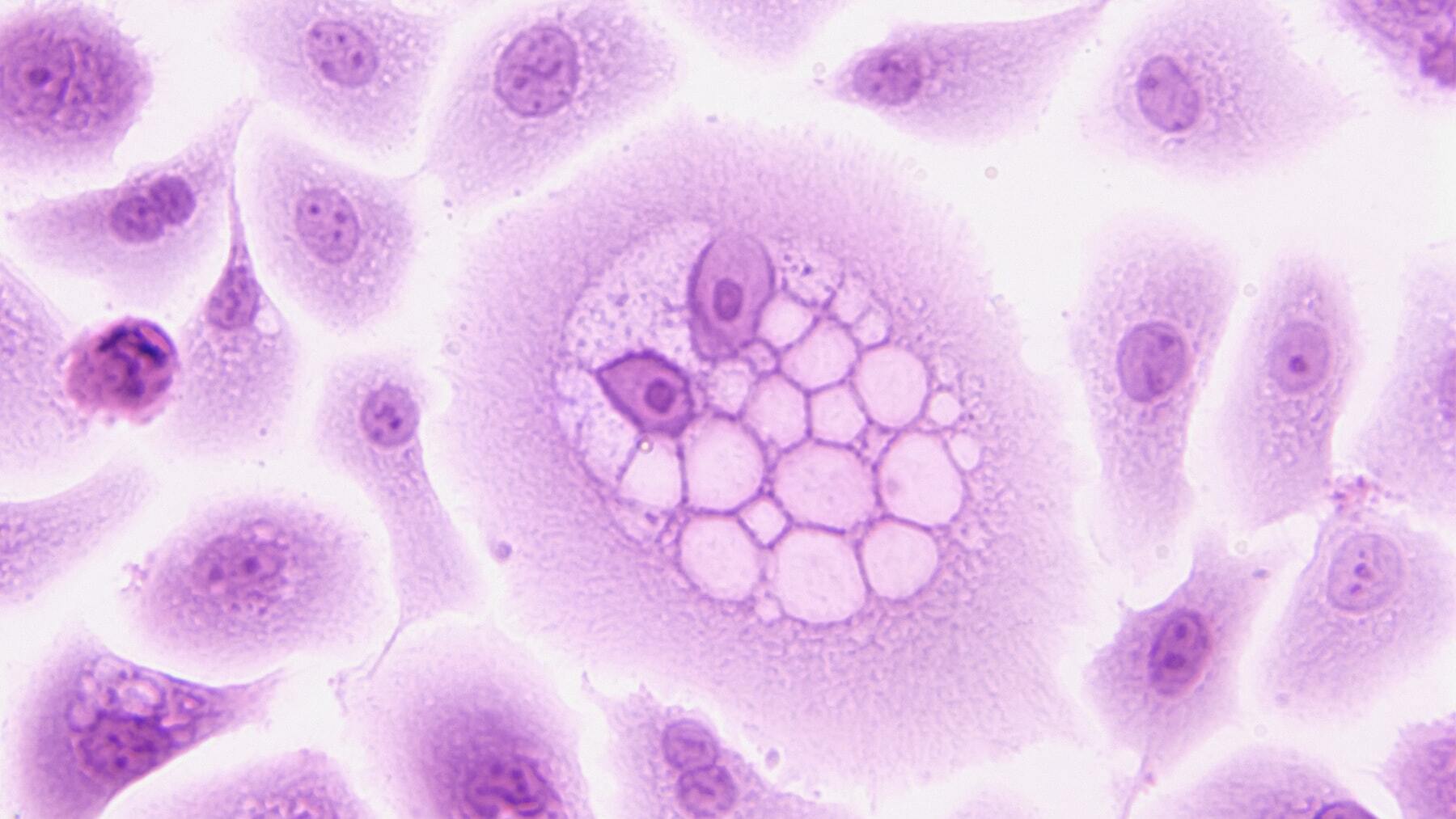 Qué son las células eucariotas y procariotas