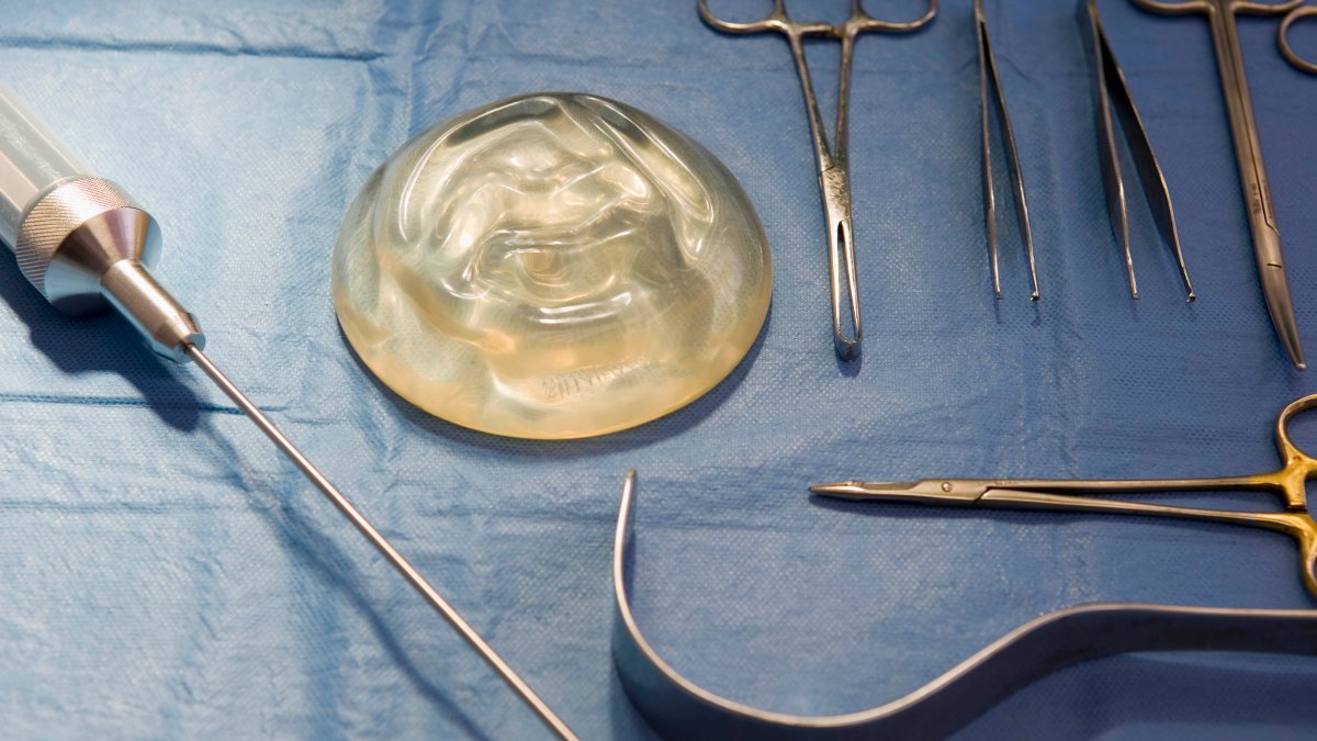 FDA reporta casos de cáncer vinculados con implantes de seno