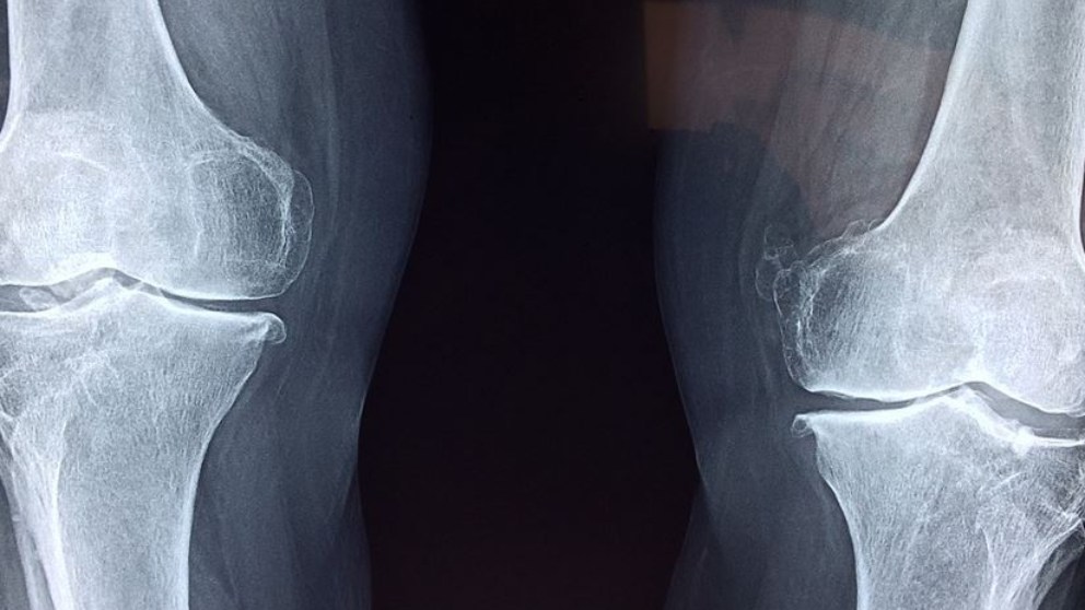 4 descubrimientos e inventos accidentales