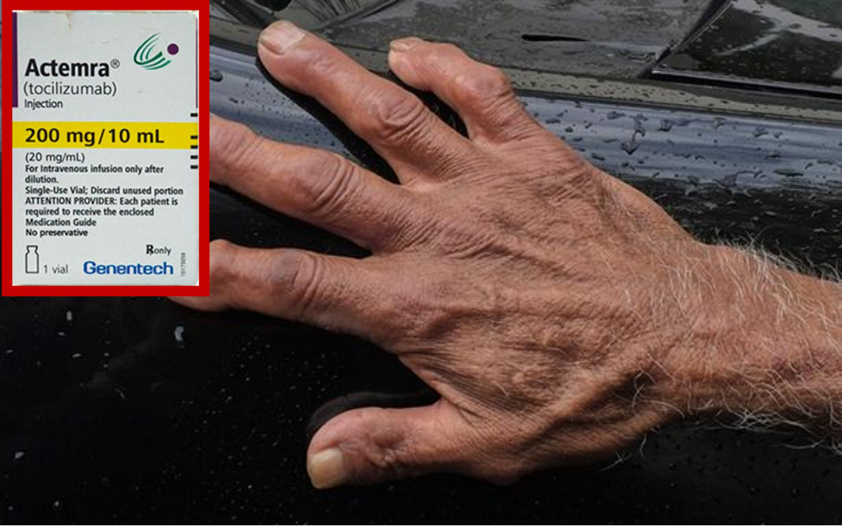 Alerta por falso medicamento contra la artritis reumatoide