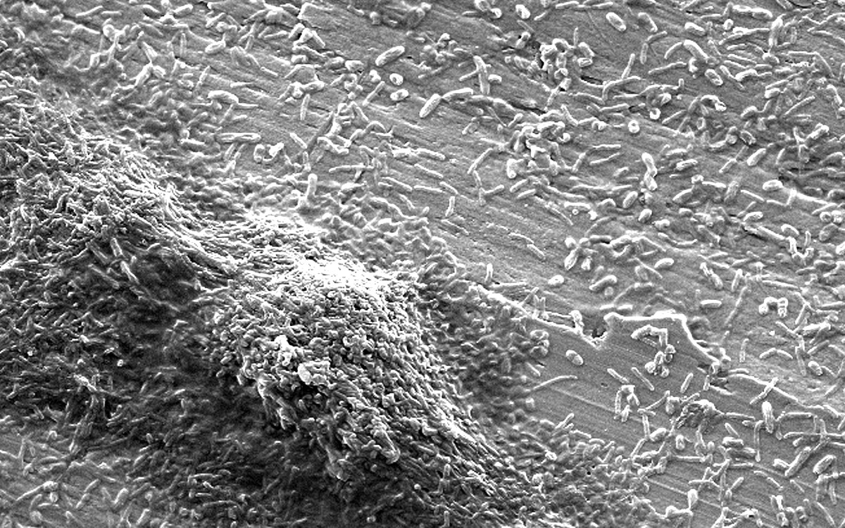 Confirman que brote de neumonía en Argentina lo ocasionó la bacteria legionella