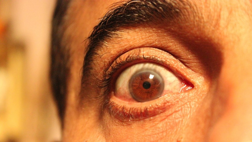 Dormir con los ojos abiertos: ¿Es posible?