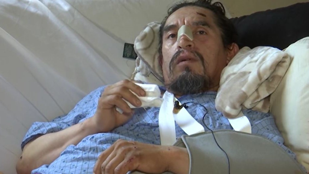 Habla víctima de arrollamiento y robo en West Valley