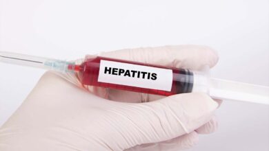Identifican 303 casos de cepas del virus de hepatitis A en Europa