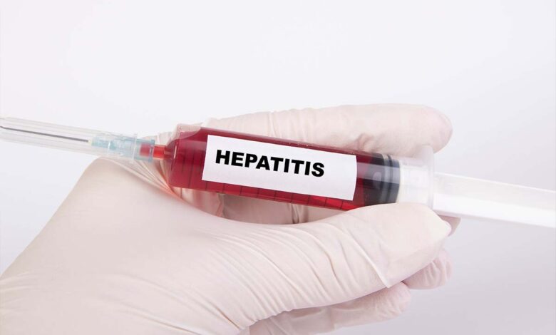 Identifican 303 casos de cepas del virus de hepatitis A en Europa