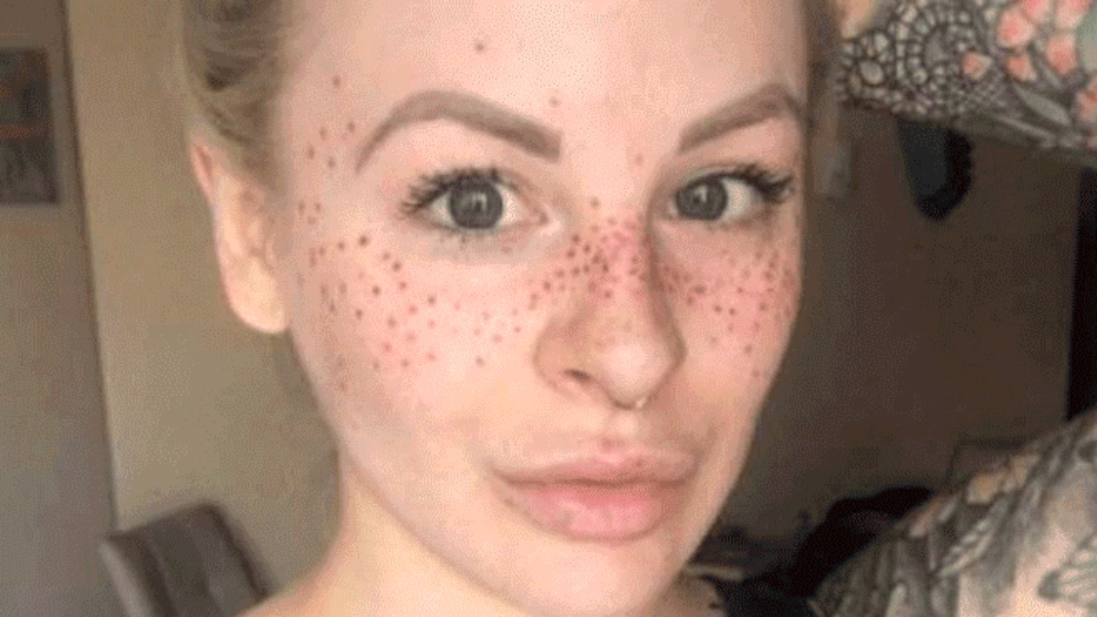Los tatuajes de pecas inundan las redes de desastres estéticos