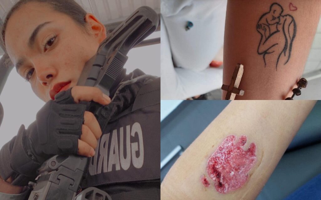 Mujer relata retiro de tatuaje con bisturí para entrar a la Marina y acoso sexual en la Guardia Nacional