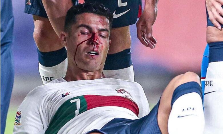 Un sangrante Cristiano Ronaldo se rehusa a abandonar partido contra República Checa | Video