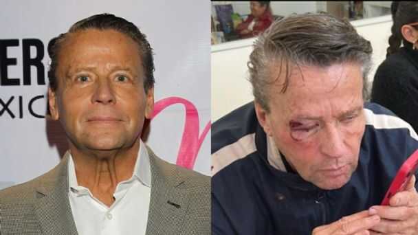 Golpean a Alfredo Adame en Tlalpan