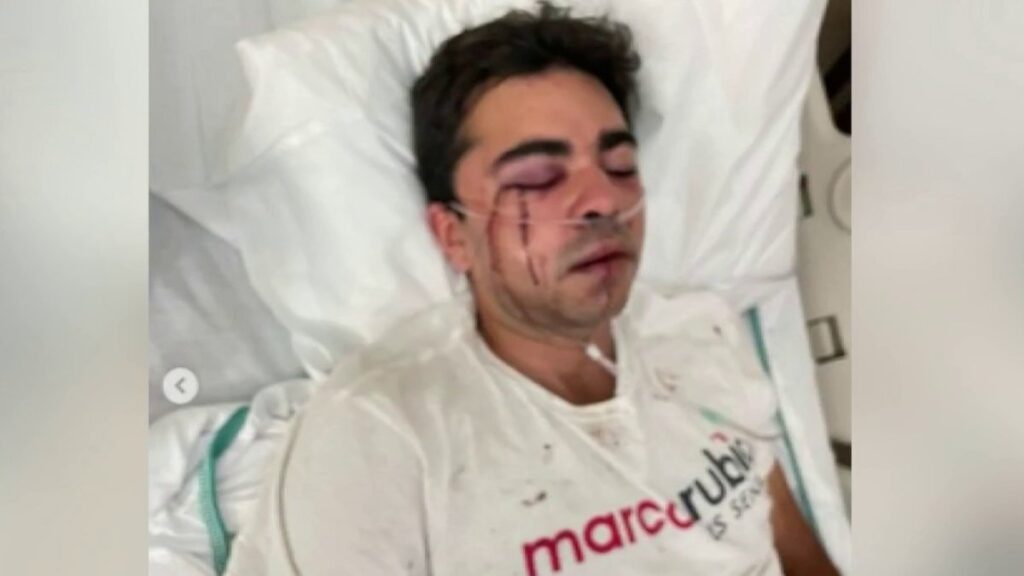 Atacan a voluntario de campaña de Marco Rubio en Hialeah