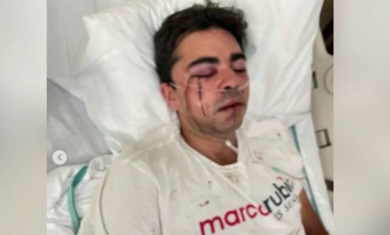 Atacan a voluntario de campaña de Marco Rubio en Hialeah