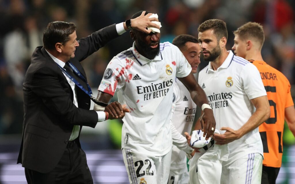 Champions League: Pinchan Real Madrid, Manchester City,  PSG y  y Juventus | Resultados