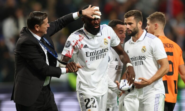 Champions League: Pinchan Real Madrid, Manchester City, PSG y y Juventus | Resultados
