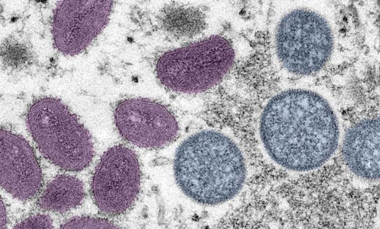 Cuatro emergencias de salud amenazan a América, advierte la OPS