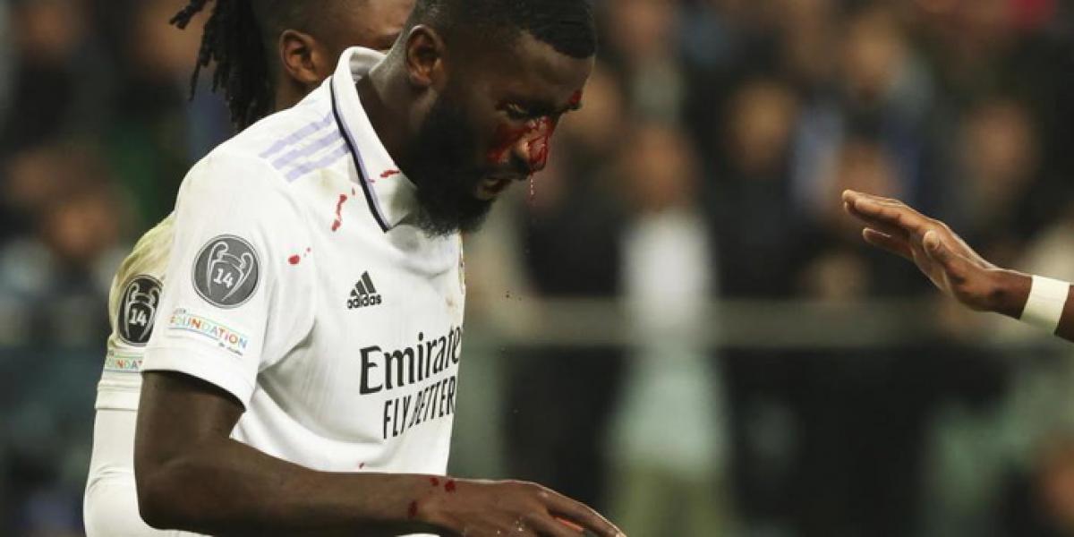 La lesión de Rüdiger no hace cambiar la hoja de ruta de Ancelotti para el Clásico