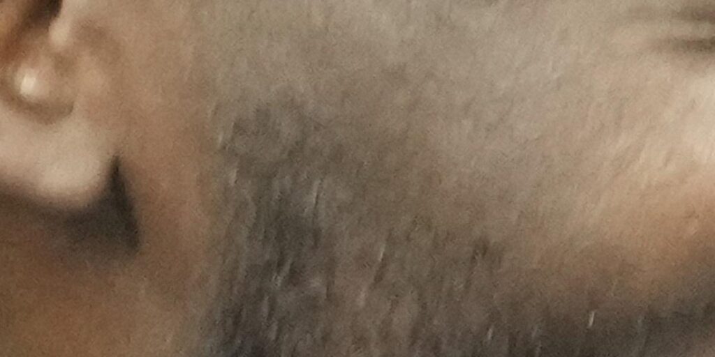 Los problemas físicos de Lukaku hacen dudar al Inter de Milán