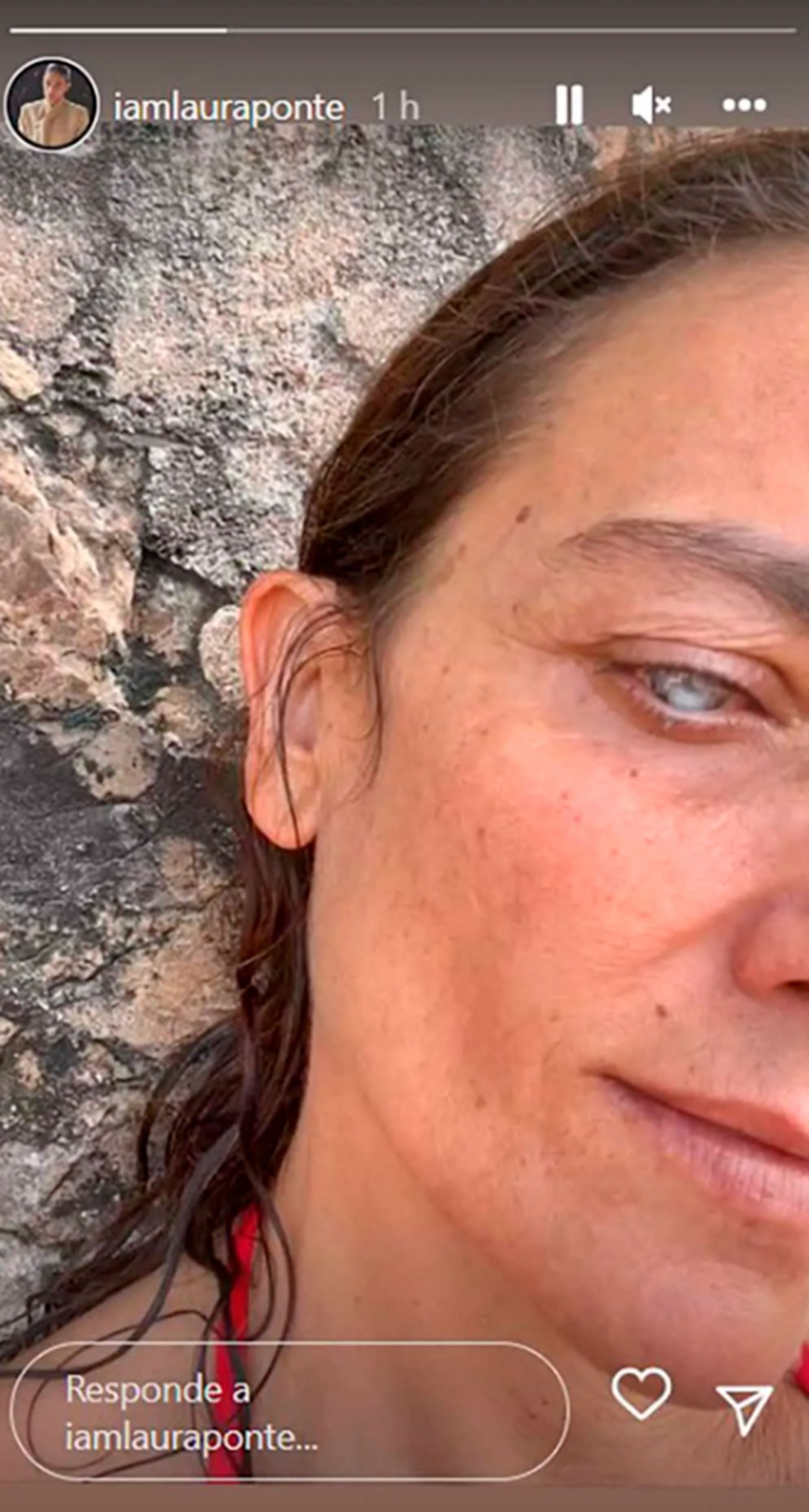 Laura Ponte muestra su ojo / Instagram: @iamlauraponte