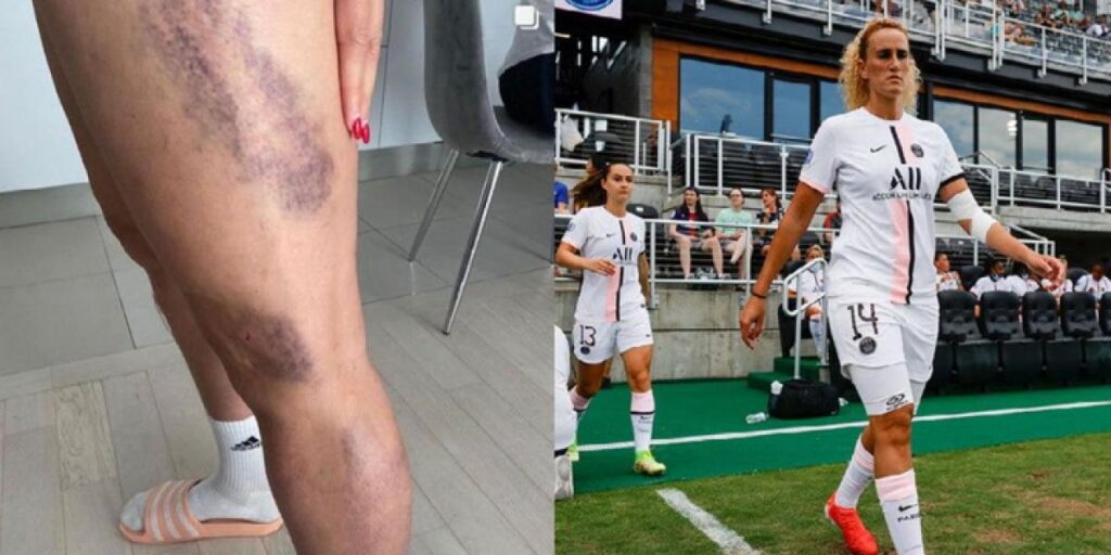 "La mano de Kheira sangraba y gritaba de dolor"