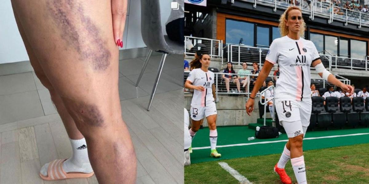 "La mano de Kheira sangraba y gritaba de dolor"