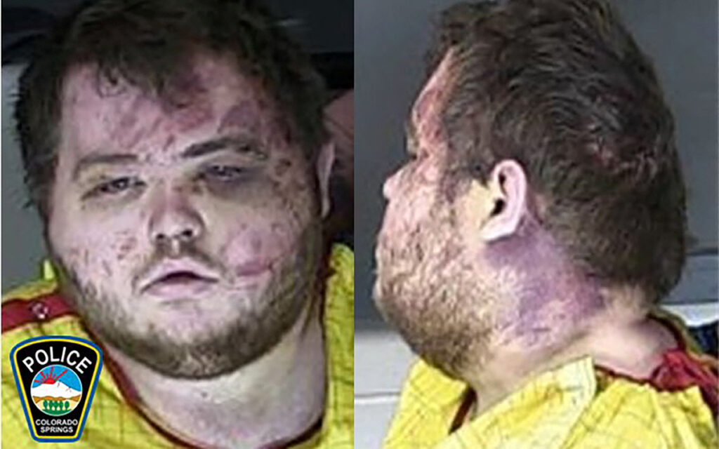 El acusado por tiroteo en bar LGBT+ en EU aparece aturdido y con moretones en audiencia