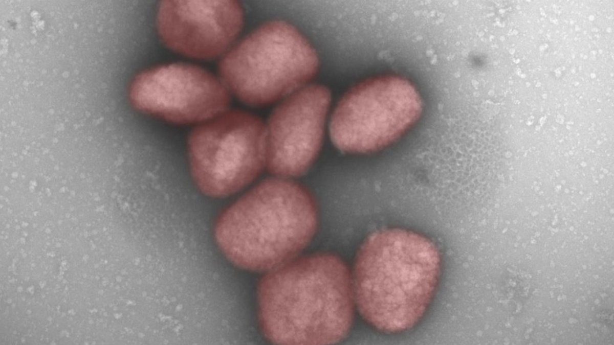 El virus de la viruela del mono podría transmitirse también por vía aérea