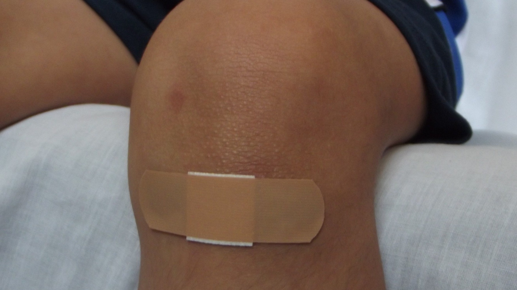 Los sanitarios advierten de los riesgos de desinfectar las heridas con agua oxigenada