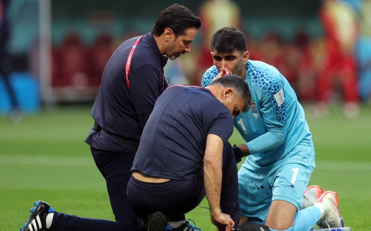 Qatar 2022: Llegó la primera nariz rota del Mundial | Fotogalería