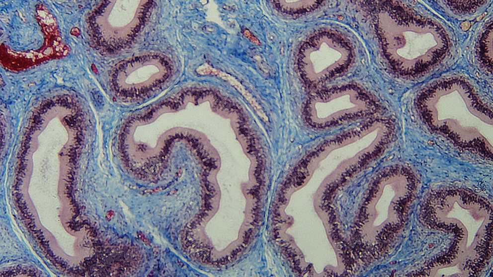 Qué es el tejido conjuntivo