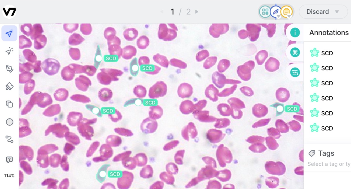 V7 obtiene $ 33 millones para automatizar datos de entrenamiento para modelos de IA de visión por computadora