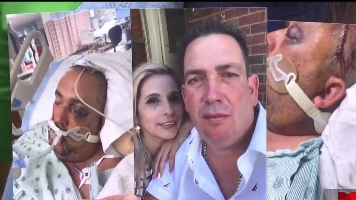 Hombre de Houston entre la vida y la muerte tras arresto